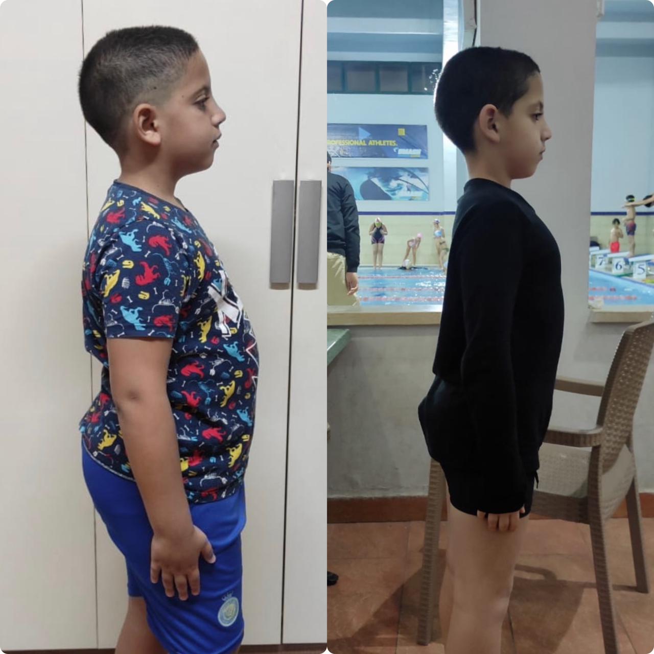 Transformation 35
